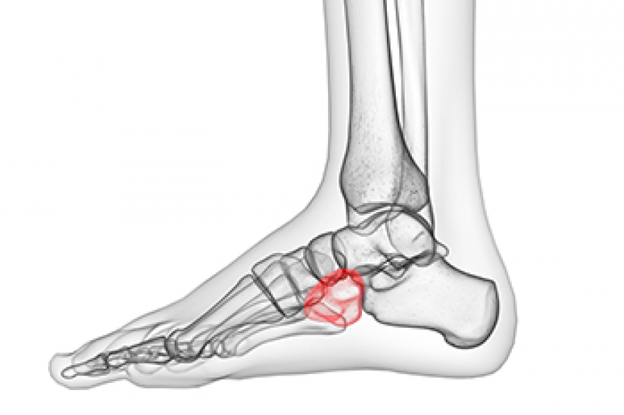 Foot & Ankle Strapping  The Feet People Podiatry